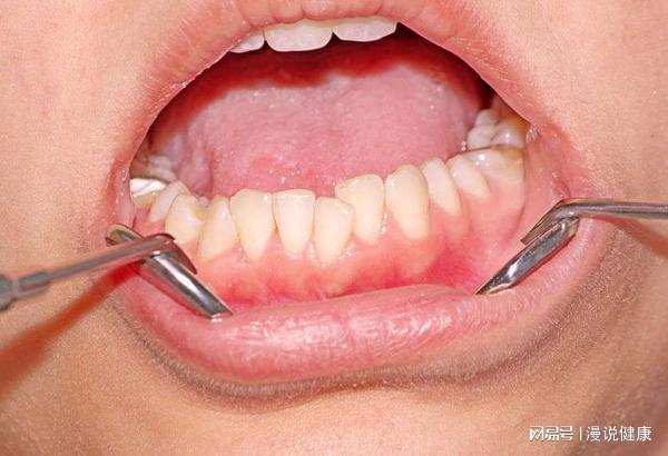 口腔問(wèn)題頻頻出現(xiàn)？別不當(dāng)回事，它的健康與全身健康息息相關(guān)！